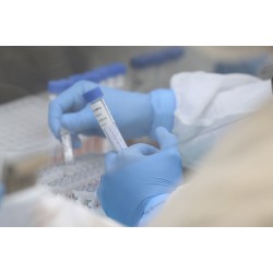 Primeiros casos de Covid-19 foram confirmados há um ano